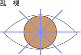乱視の図