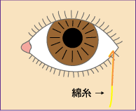涙量検査
